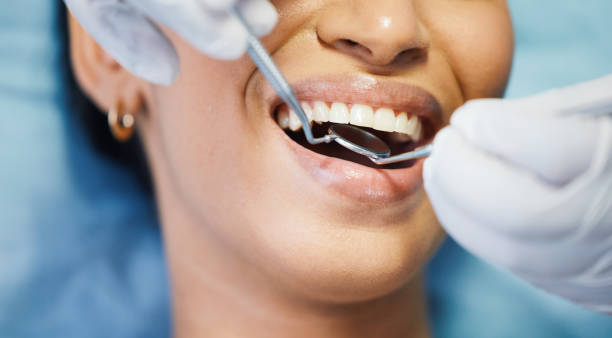 Best Emergency Dental Care for Trauma or Injury in Essex, IL
