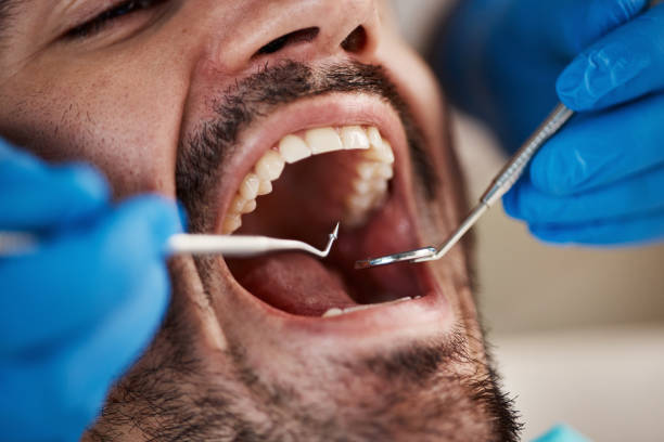 Best Pediatric Emergency Dentist in Essex, IL