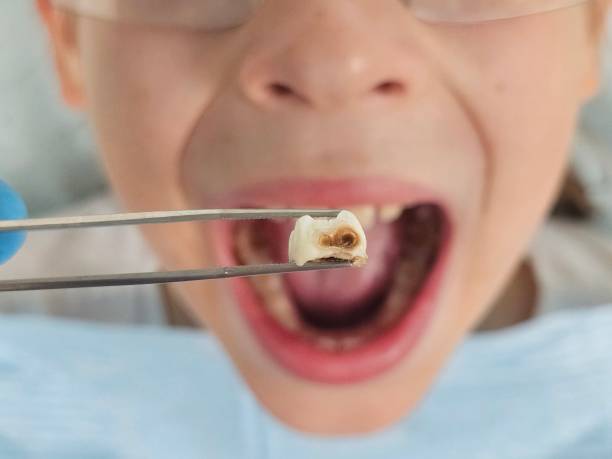 Best Same-Day Emergency Dentist in Essex, IL