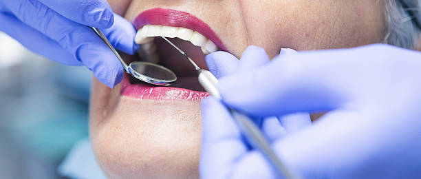 Best Emergency Tooth Extraction in Essex, IL